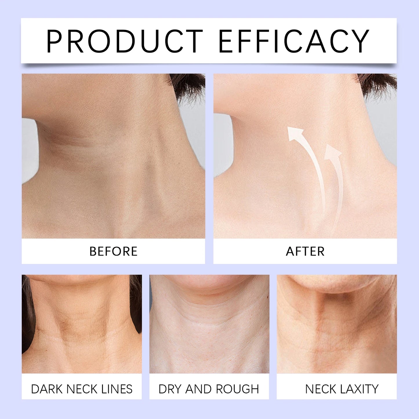 OUHOE Neck Cream Moisturizing Hydrating Moisturizing Downplaying Neck Lines Nourishing Lifting Firming Neck Rejuvenating Cream